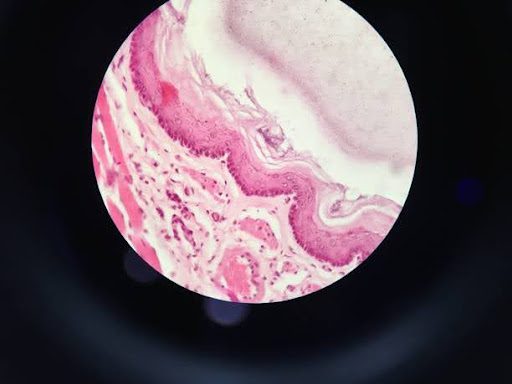 neurological-breakdown-explained:-the-brain-damage-that-makes-ozdikenosis-fatal